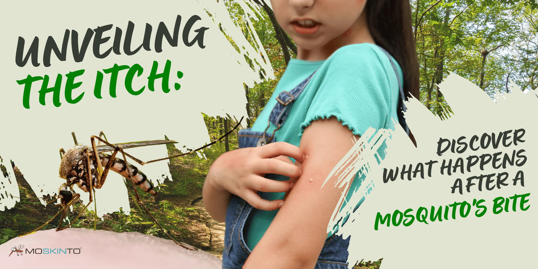Unveiling-the-Itch-Discover-What-Happens-After-a-Mosquito-s-Bite Moskinto USA